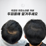 생명나무두피프렌즈 | 두피움SMP