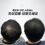 생명나무두피프렌즈 | 두피움SMP