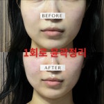 제이에스지 청주교대점 | 제이에스테틱 청주점