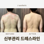 제이에스지 청주교대점 | 제이에스테틱 청주점