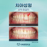 이턱편한치과의원