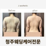 제이에스지 청주교대점 | 제이에스테틱 청주점
