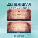 이턱편한치과의원