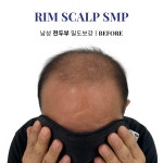 림스칼프 대구본점