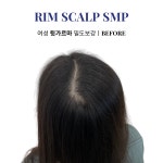 림스칼프 대구본점