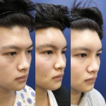 강남더뷰티성형외과의원