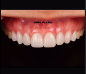 스마일스튜디오치과의원