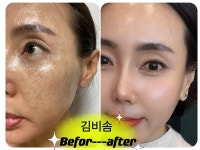 인셀덤 샤이닝 드림 | 인셀덤드림빛나다