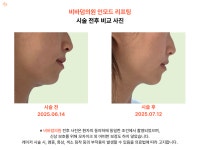 비바덤의원