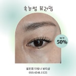 이뮨팩토리 온빛