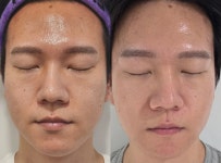 나나스킨케어&왁싱