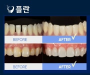 플란치과기공소