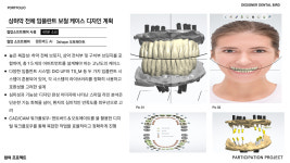 덴탈버드Ai