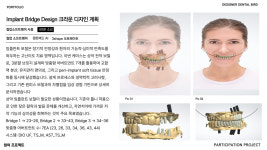 덴탈버드Ai