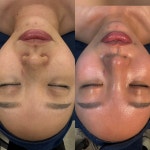 뷔에고에스테틱 김포점