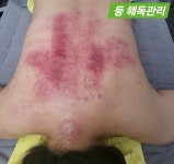 뷰티엔 스킨