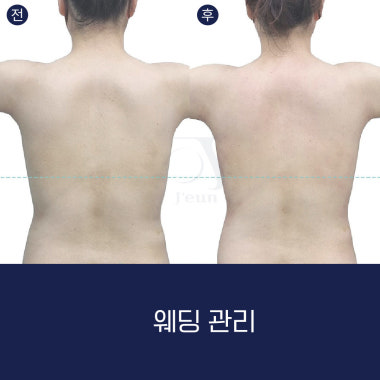 광고 이미지