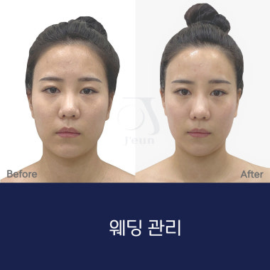 광고 이미지