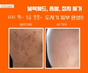 셀앤비에스테틱 강남선릉점