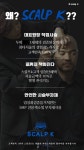 두피문신 스칼프K