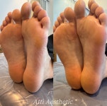 아띠에스테틱(ATTIAESTHETIC) | 아띠에스테틱