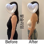 아띠에스테틱(ATTIAESTHETIC) | 아띠에스테틱