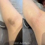 아띠에스테틱(ATTIAESTHETIC) | 아띠에스테틱