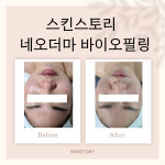 Skin essay(스킨 에세이) | 스킨스토리