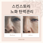 Skin essay(스킨 에세이) | 스킨스토리