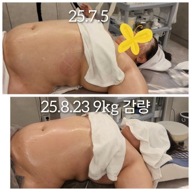 광고 이미지