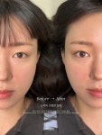 더올림