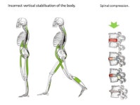 업스파인 척추체형운동센터