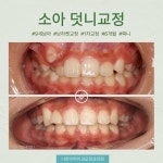 나란이턱치과교정과의원 인천부평