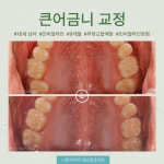 나란이턱치과교정과의원 인천부평