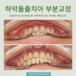 나란이턱치과교정과의원 인천부평