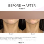 스노우의원 여수점