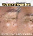 뷰티엔 스킨