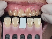 하나치과기공소