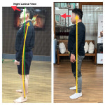 수밸런스체형교정센터