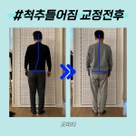 곳피티