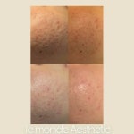 르몽드에스테틱