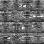 백세튼튼플란트치과의원
