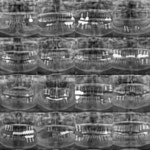 백세튼튼플란트치과의원
