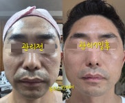 뷰티스스킨케어 | 뷰티스킨케어