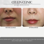 셀린의원 수원망포점