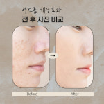 안산피부관리 에스알뷰티센터