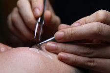 아인피부체형전문샵