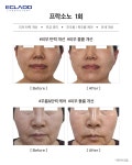 HK뷰티&스킨