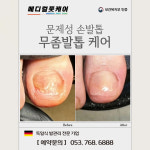 독일식문제성손발관리전문점푸스플레게장연자 | 내성발톱 무좀발톱 메디컬풋케어 & 푸스플레게