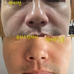 뷰티스스킨케어 | 뷰티스킨케어